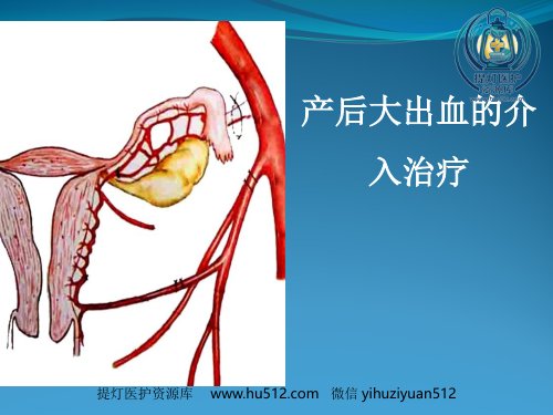 a01611 产后大出血的介入治疗 30页PPT课件可编辑无水印直接可用